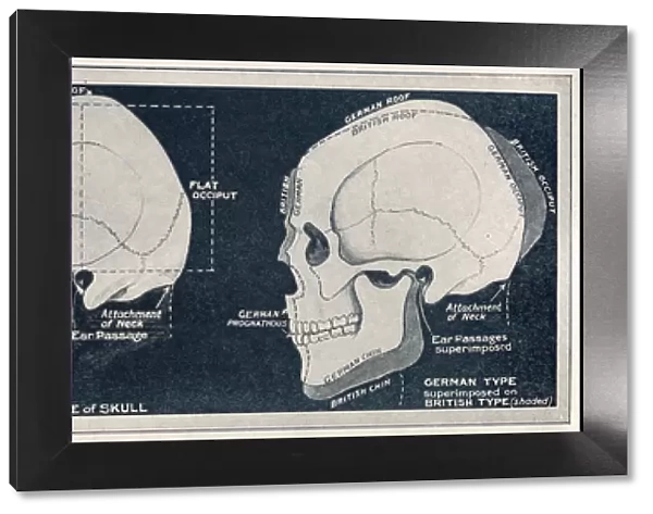 Comparison of British & German skull shapes, WW1
