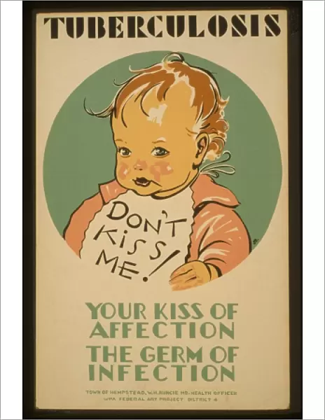 Tuberculosis Don t kiss me! : Your kiss of affection - the g
