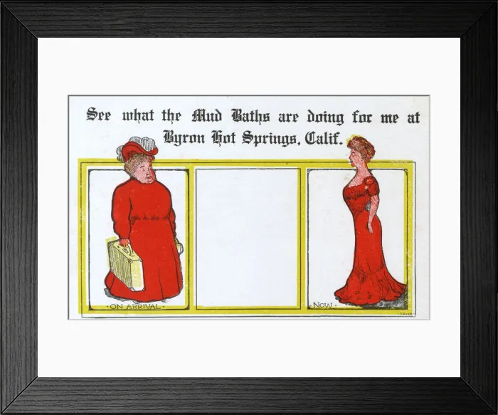 Framed Print : Benefits of a Mud Bath - Slimming Success Framed Print : Benefits of a Mud Bath - Slimming Success