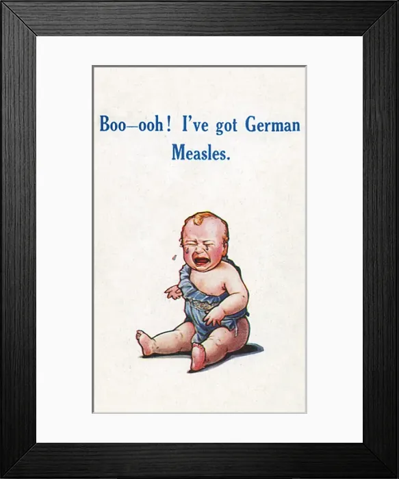 Framed Print : Baby with German Measles - WWI connection Framed Print : Baby with German Measles - WWI connection