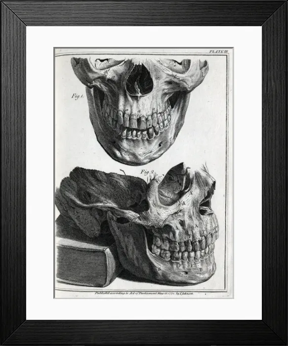 Framed Print : Upper and lower human jaws Framed Print : Upper and lower human jaws