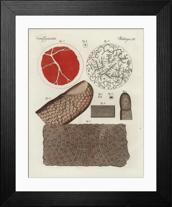 Framed Print : Human finger, skin, blood, serum and salt crystals Framed Print : Human finger, skin, blood, serum and salt crystals
