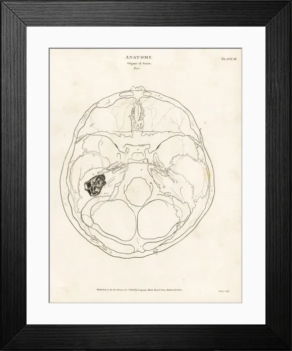 Framed Print : Anatomy of the human ear Framed Print : Anatomy of the human ear