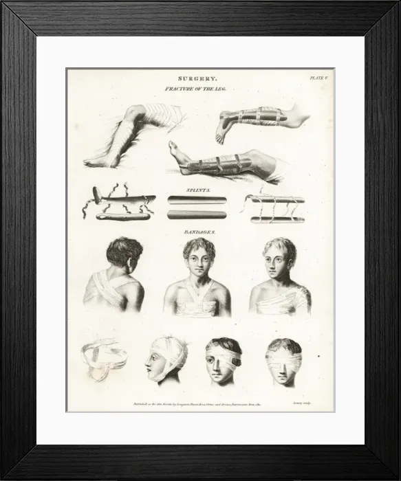 Framed Print : Surgical procedures from the 19th century Framed Print : Surgical procedures from the 19th century