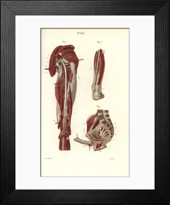 Framed Print : Sciatic nerve and the sacral plexus Framed Print : Sciatic nerve and the sacral plexus