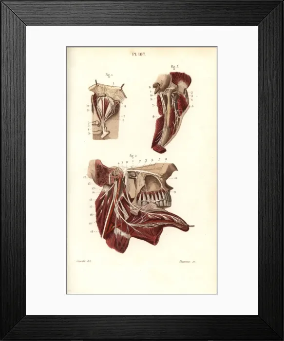 Framed Print : Opthalmic and maxillary nerves in the fifth cranial nerve Framed Print : Opthalmic and maxillary nerves in the fifth cranial nerve