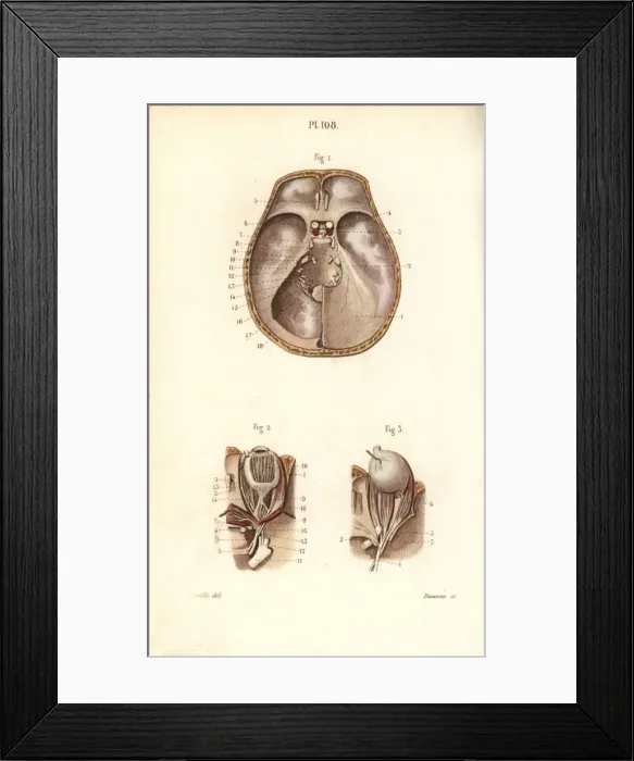 Framed Print : Nerves in the skull and to the eye Framed Print : Nerves in the skull and to the eye