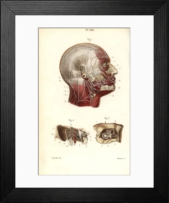Framed Print : Facial and auditory nerves Framed Print : Facial and auditory nerves