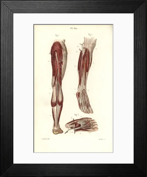 Framed Print : Saphenous and medial plantar nerves Framed Print : Saphenous and medial plantar nerves