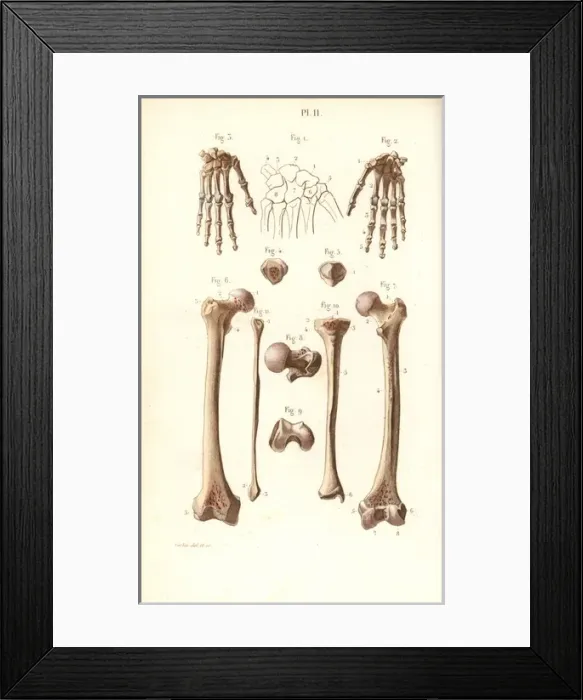Framed Print : Hand, hip and leg bones: femur and tibia Framed Print : Hand, hip and leg bones: femur and tibia