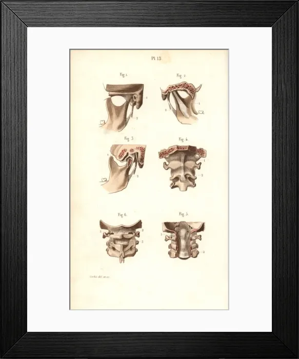 Framed Print : Jaw bone and neck Framed Print : Jaw bone and neck