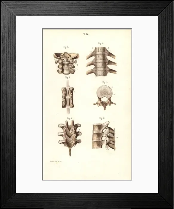 Framed Print : Neck and spinal column Framed Print : Neck and spinal column