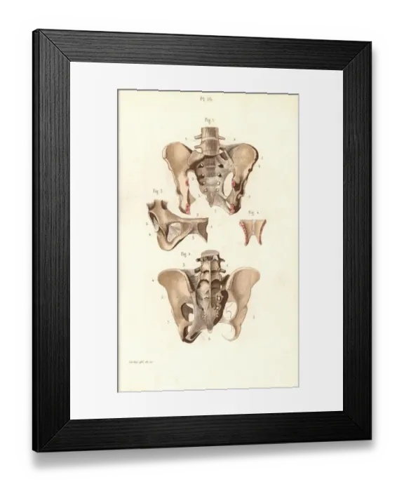 Framed Print : Pelvis front and back Framed Print : Pelvis front and back