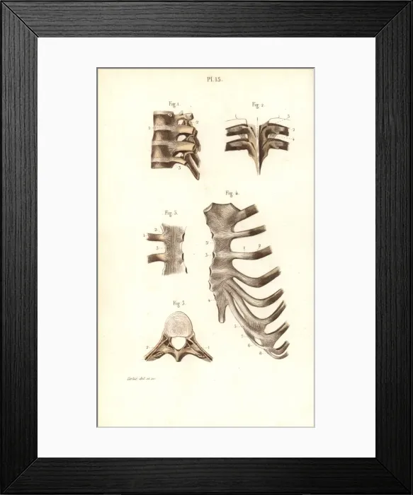 Framed Print : Spine, ribs and sternum Framed Print : Spine, ribs and sternum