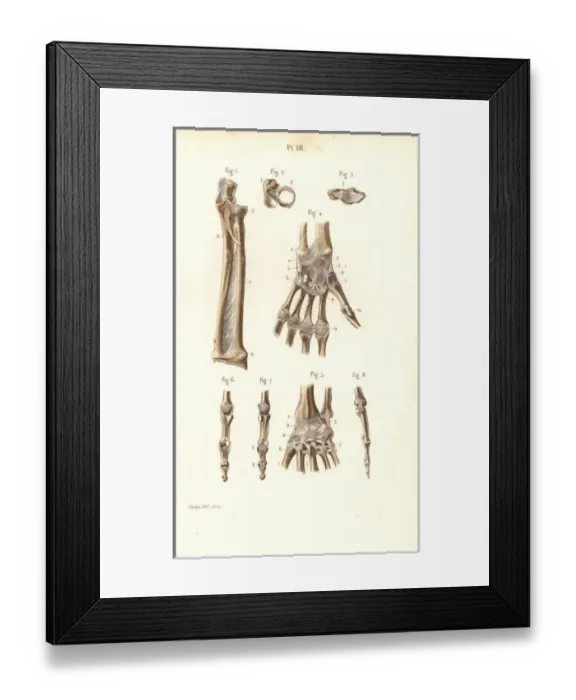 Framed Print : Forearm, wrist and finger bones Framed Print : Forearm, wrist and finger bones