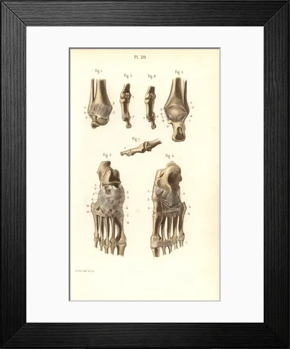 Framed Print : Ankle and foot bones