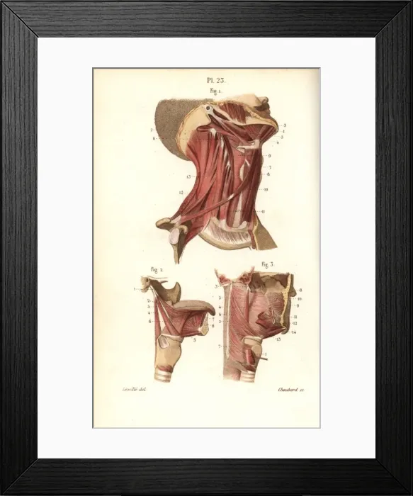 Framed Print : Muscles of the neck, tongue and throat Framed Print : Muscles of the neck, tongue and throat
