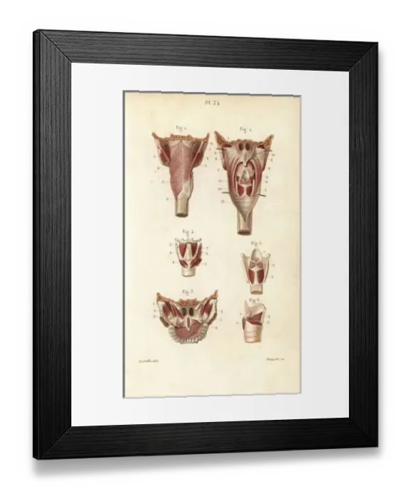 Framed Print : Muscles of the pharynx and larynx
