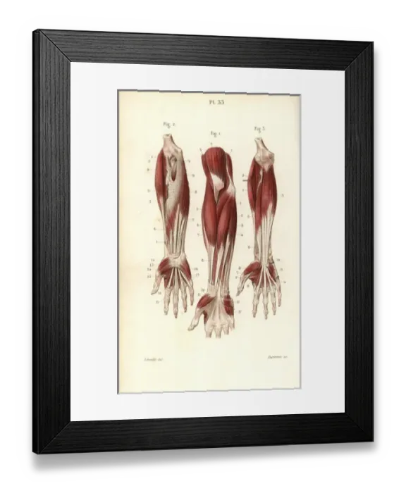 Framed Print : Muscles of the forearm and wrist