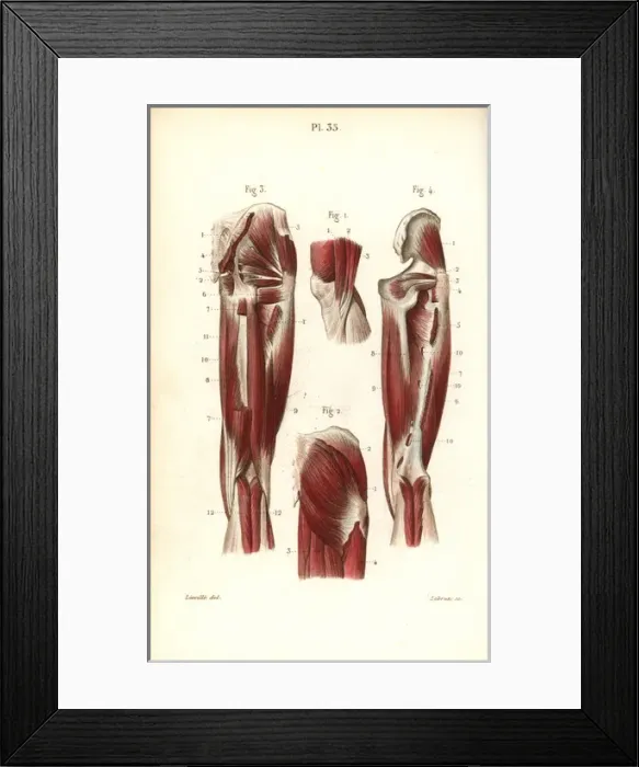 Framed Print : Muscles and tendons of the thigh and knee Framed Print : Muscles and tendons of the thigh and knee