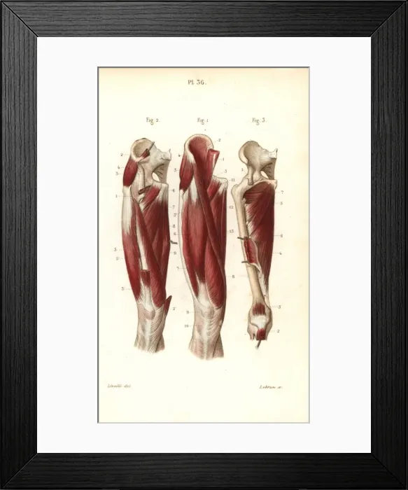 Framed Print : Muscles and tendons of the thigh Framed Print : Muscles and tendons of the thigh