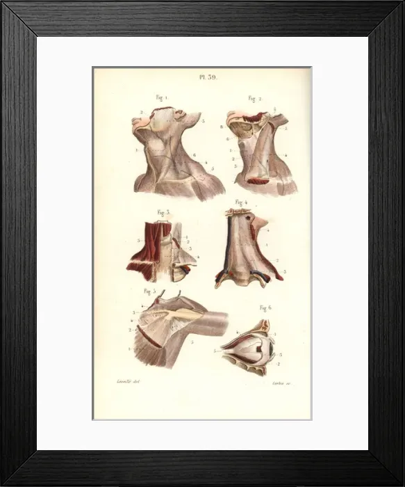 Framed Print : Aponeuroses of the neck, shoulder and eye Framed Print : Aponeuroses of the neck, shoulder and eye