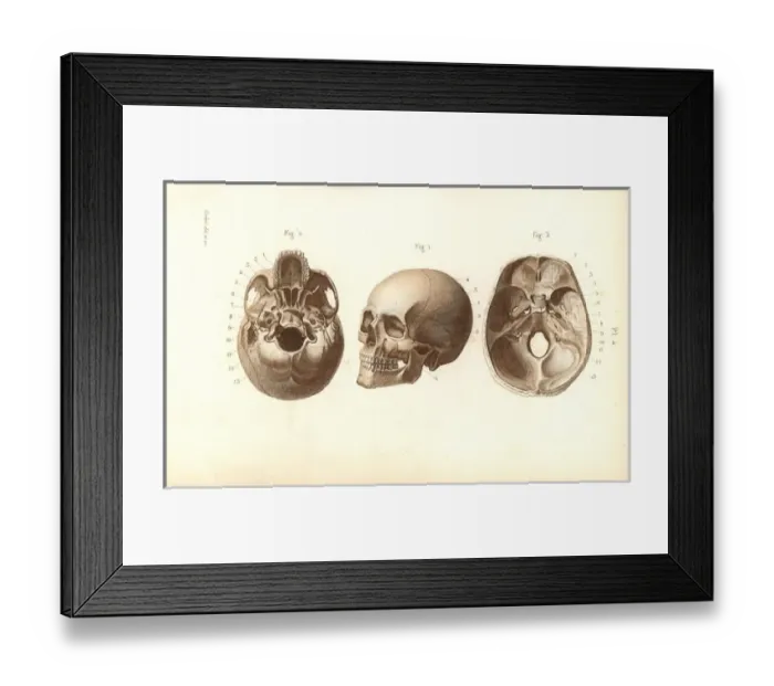 Framed Print : Views of the skull Framed Print : Views of the skull