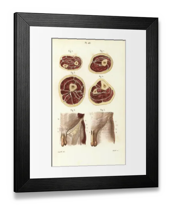 Framed Print : Aponeuroses of the torso in cross-section Framed Print : Aponeuroses of the torso in cross-section