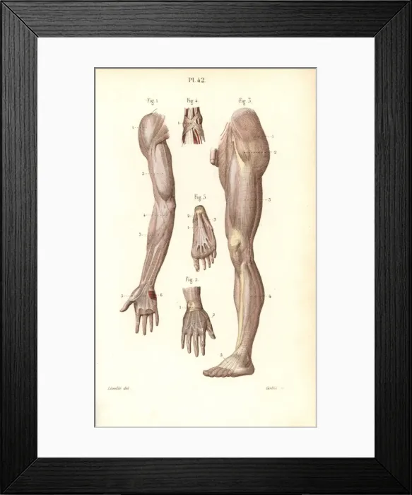 Framed Print : Aponeuroses of the arm, leg, hand and foot Framed Print : Aponeuroses of the arm, leg, hand and foot