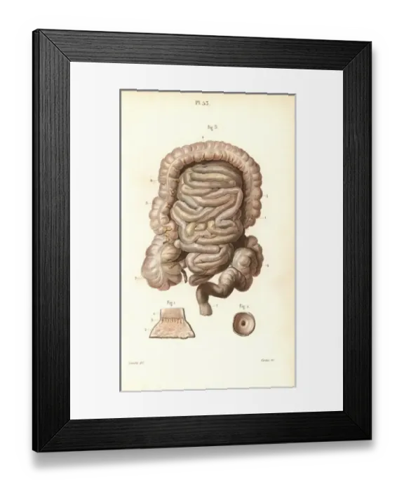 Framed Print : The intestines Framed Print : The intestines