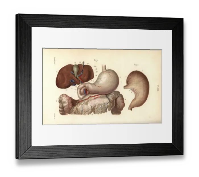 Framed Print : Stomach, duodenum and liver Framed Print : Stomach, duodenum and liver