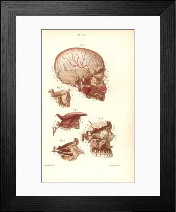Framed Print : Circulatory system to the brain Framed Print : Circulatory system to the brain