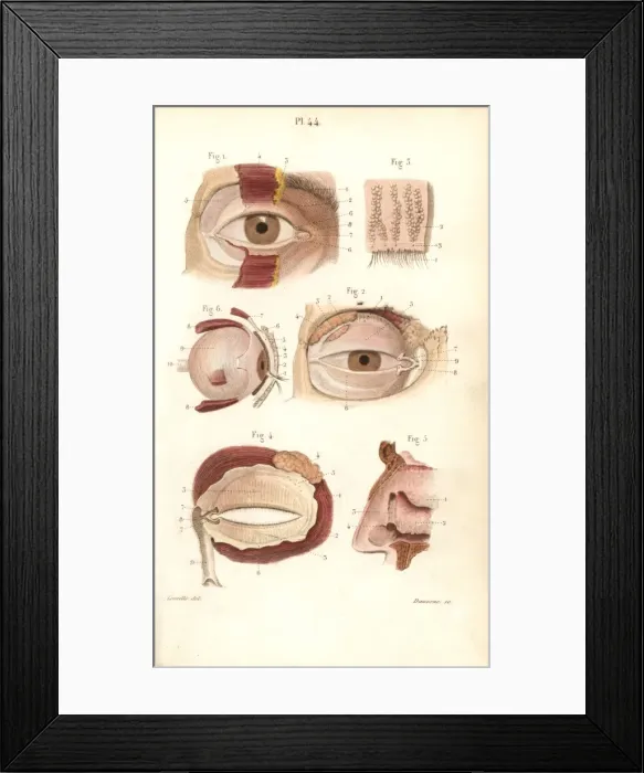 Framed Print : Sections of the eye socket and nasal cavity Framed Print : Sections of the eye socket and nasal cavity