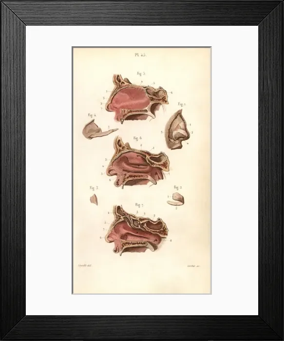 Framed Print : Sections of the nasal cavity Framed Print : Sections of the nasal cavity