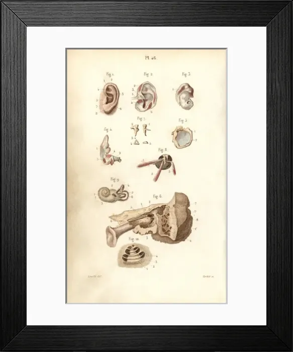 Framed Print : Ear and eardrum Framed Print : Ear and eardrum