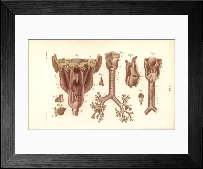 Framed Print : Sections of the pharynx and larynx Framed Print : Sections of the pharynx and larynx