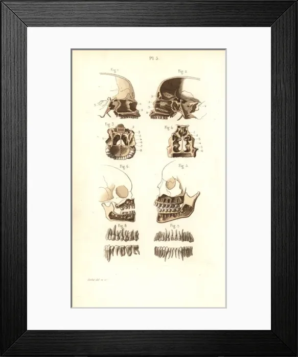 Framed Print : Sections of skull, nasal cavity, jaw and teeth Framed Print : Sections of skull, nasal cavity, jaw and teeth