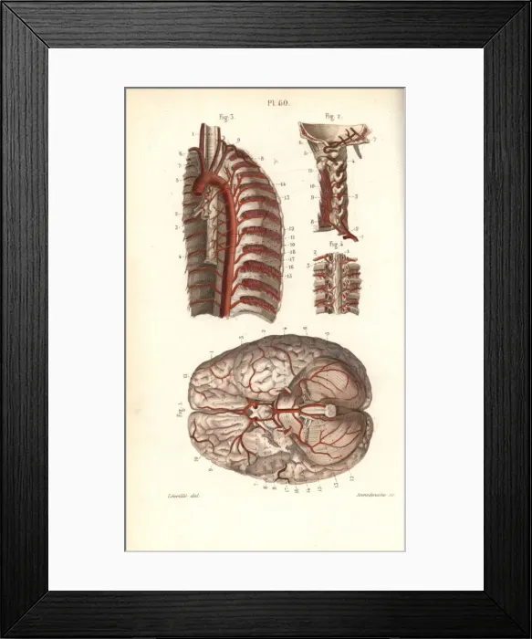 Framed Print : Circulatory system to the brain and spine Framed Print : Circulatory system to the brain and spine