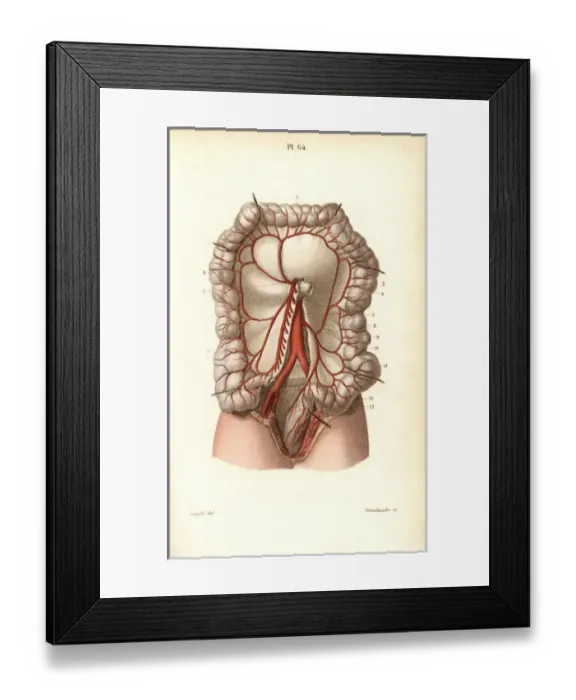 Framed Print : Circulatory system to the intestines Framed Print : Circulatory system to the intestines
