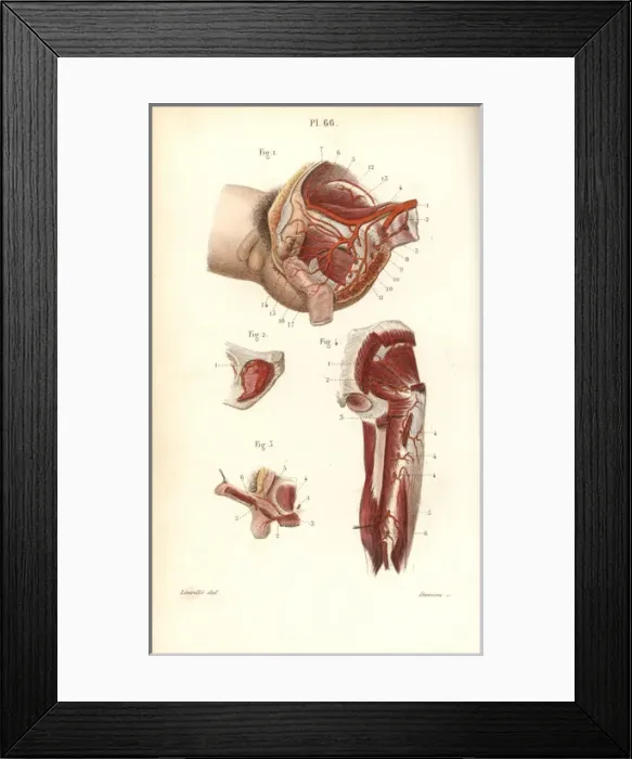 Framed Print : Circulatory system to the pelvis and arm Framed Print : Circulatory system to the pelvis and arm