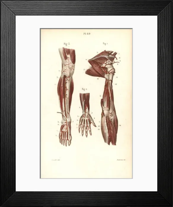 Framed Print : Circulatory system to the arm and hand Framed Print : Circulatory system to the arm and hand