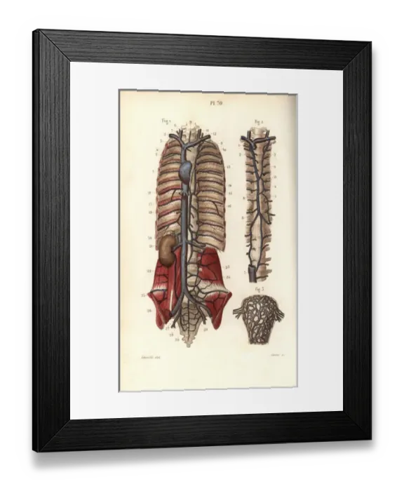 Framed Print : Circulatory system to the spine and uterus Framed Print : Circulatory system to the spine and uterus