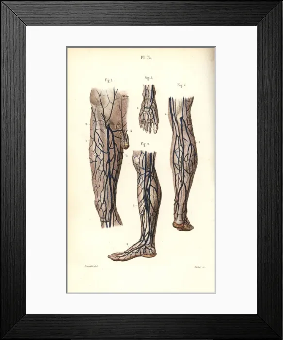 Framed Print : Veins to the leg and foot Framed Print : Veins to the leg and foot