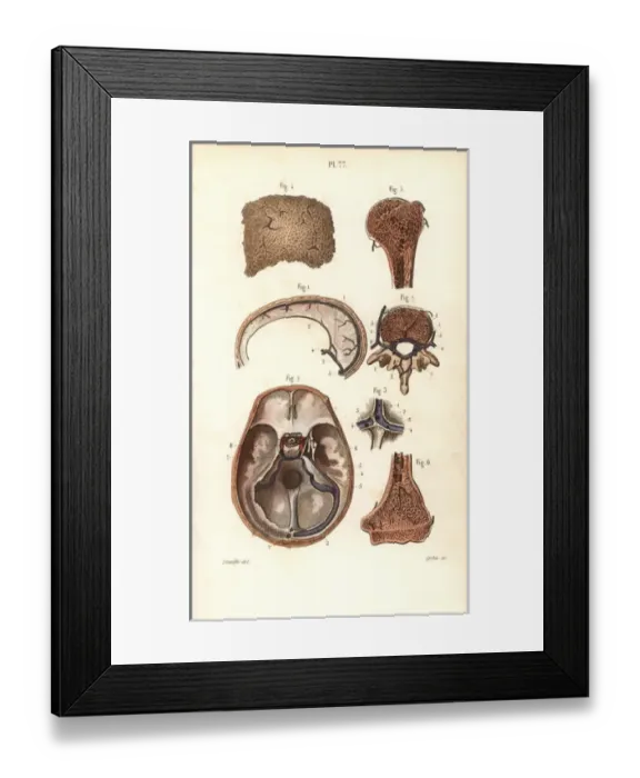 Framed Print : Sinuses or cavities in skull, humerus and vertebrae Framed Print : Sinuses or cavities in skull, humerus and vertebrae