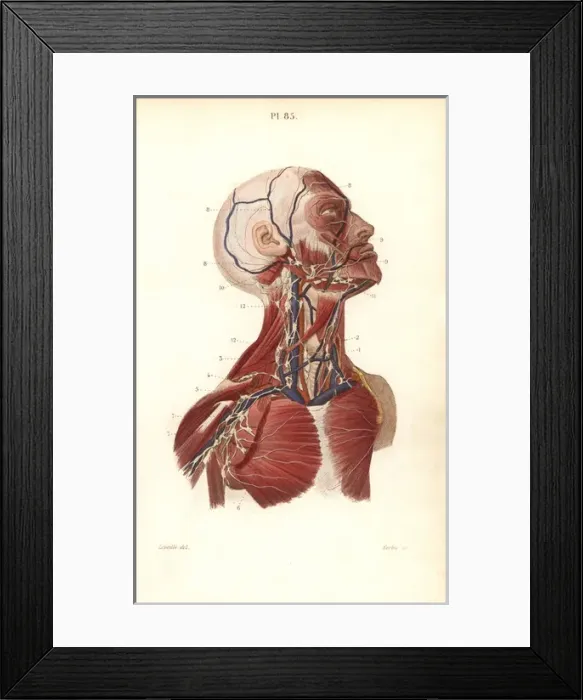 Framed Print : Lymph nodes and vessels in the head, neck and chest Framed Print : Lymph nodes and vessels in the head, neck and chest