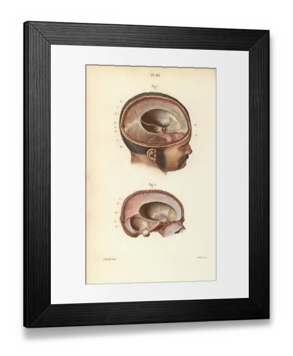 Framed Print : Cross sections through the skull Framed Print : Cross sections through the skull