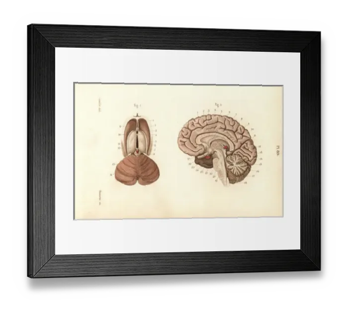 Framed Print : Cross sections through the brain Framed Print : Cross sections through the brain