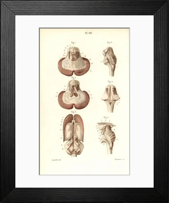 Framed Print : Sections through the cerebellum, ventricular system Framed Print : Sections through the cerebellum, ventricular system