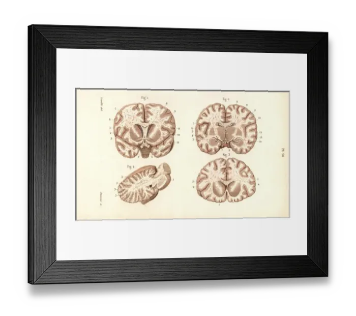 Framed Print : Sections through the brain Framed Print : Sections through the brain