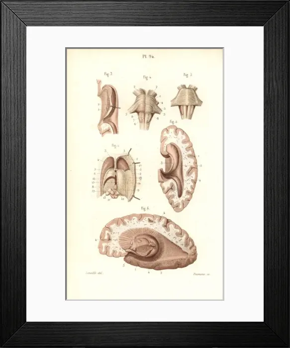 Framed Print : Brain, pons, medulla oblongata, pineal gland, etc Framed Print : Brain, pons, medulla oblongata, pineal gland, etc